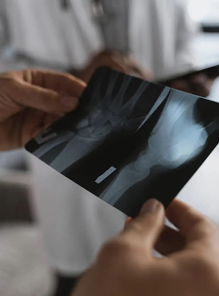 xCures automatically surfaces the documentation that supports medical necessity for testing.
